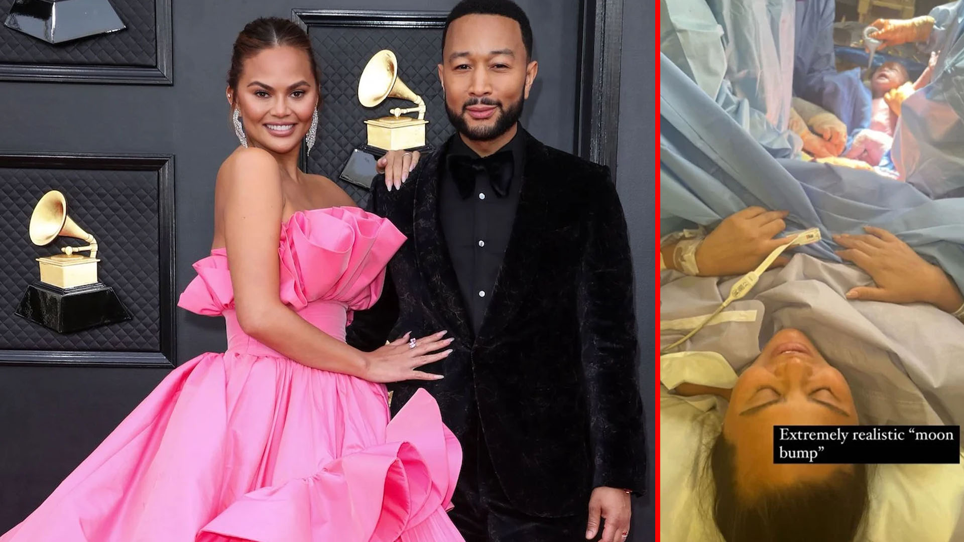 Chrissy Teigen Shared C Section Photo To Prove Not Using